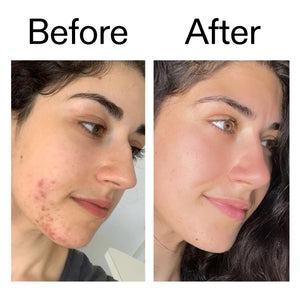 Before and after showing reduced blemishes