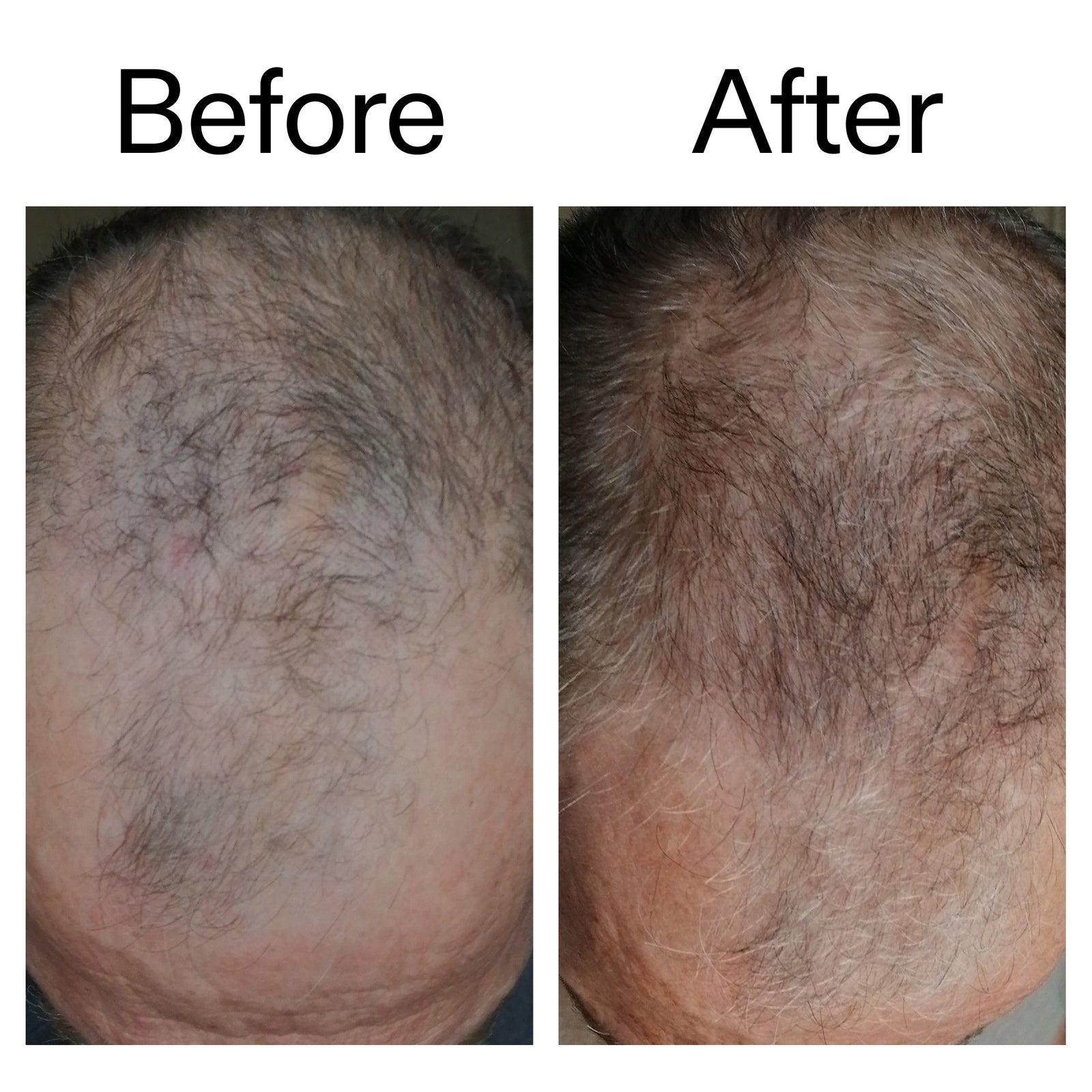 Before & after of customer using Caffeine Scalp Treatment