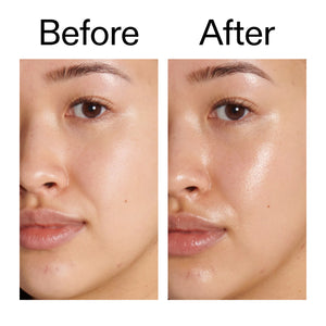 Before and after comparison of a person's face with visible skin improvement using Dewy Sunscreen SPF 30