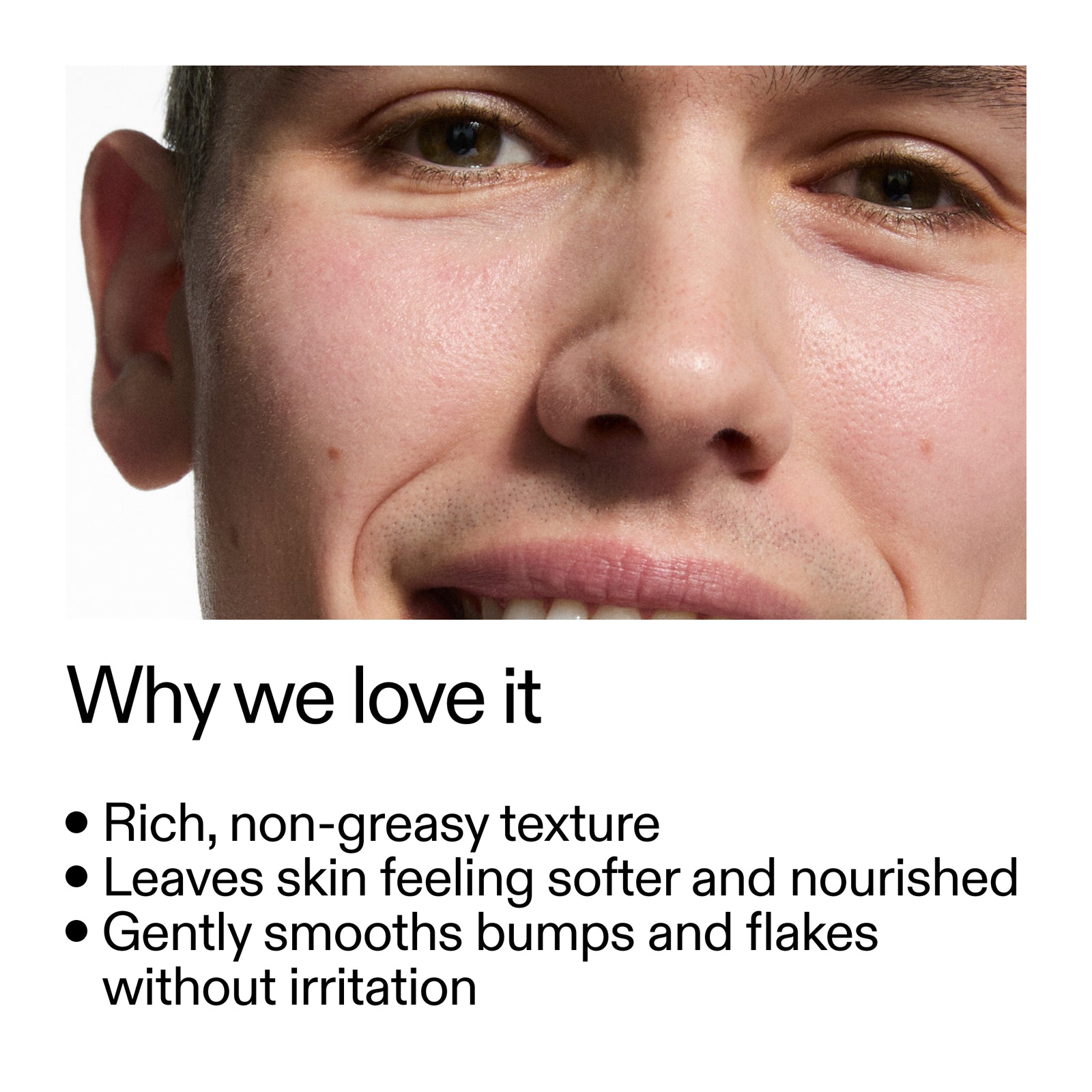 Close-up of a person's face with text highlighting 10% Urea Moisturiser benefits on a white background