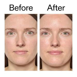 Before and after comparison of a woman's face with visible skin texture adifferences after using Exosome Hydro-Glow Complex