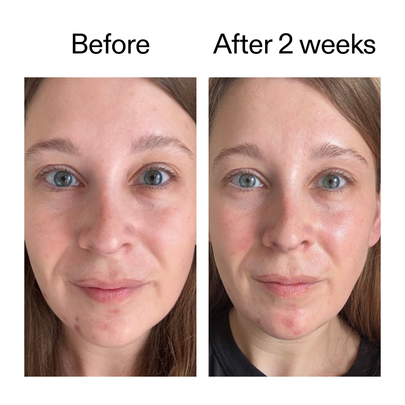 Before and after comparison of a person's face with text indicating time elapsed.