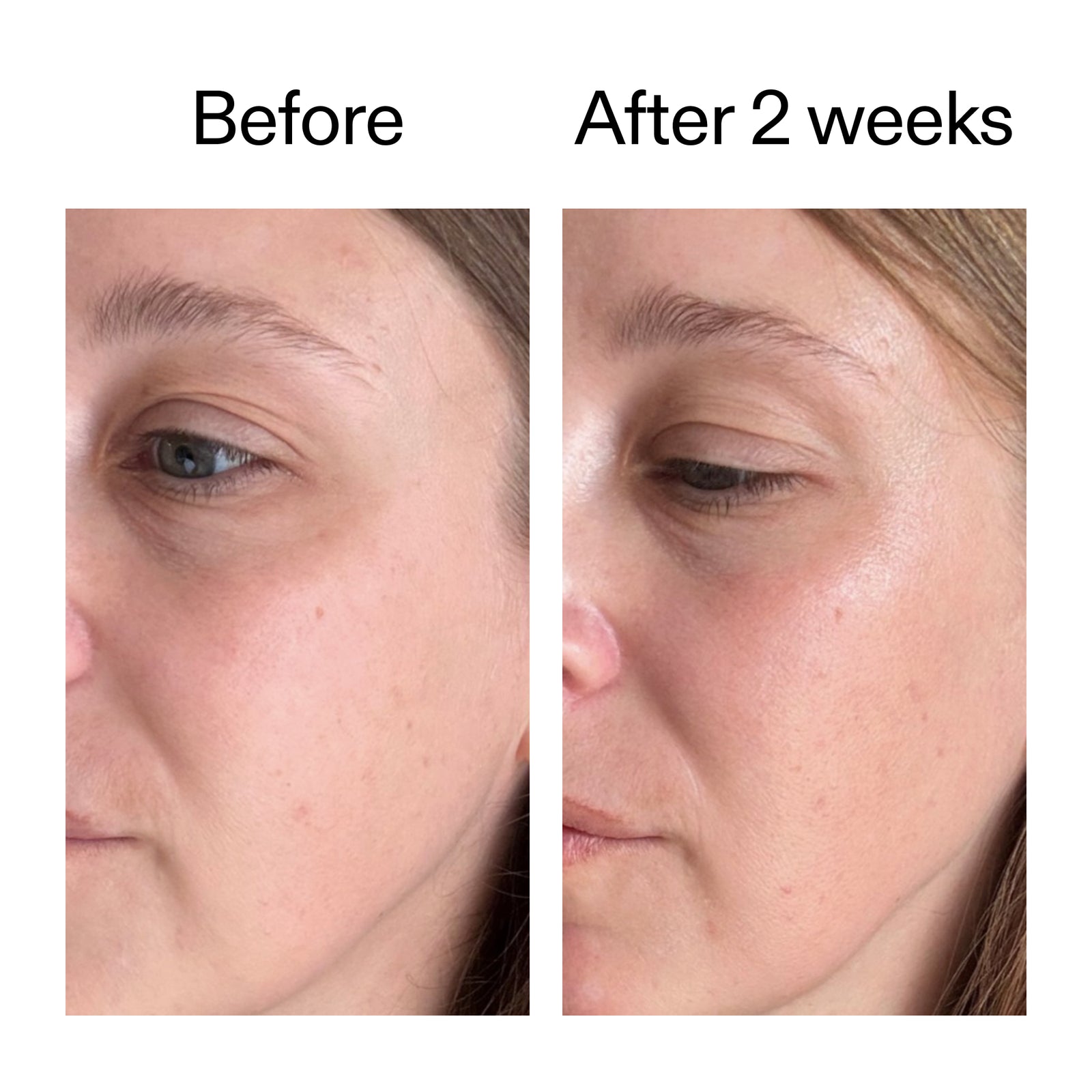 Before and after comparison of a woman's face with text indicating a time lapse.