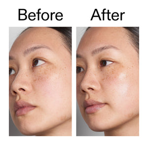 Before and after using Hyaluronic Acid Serum