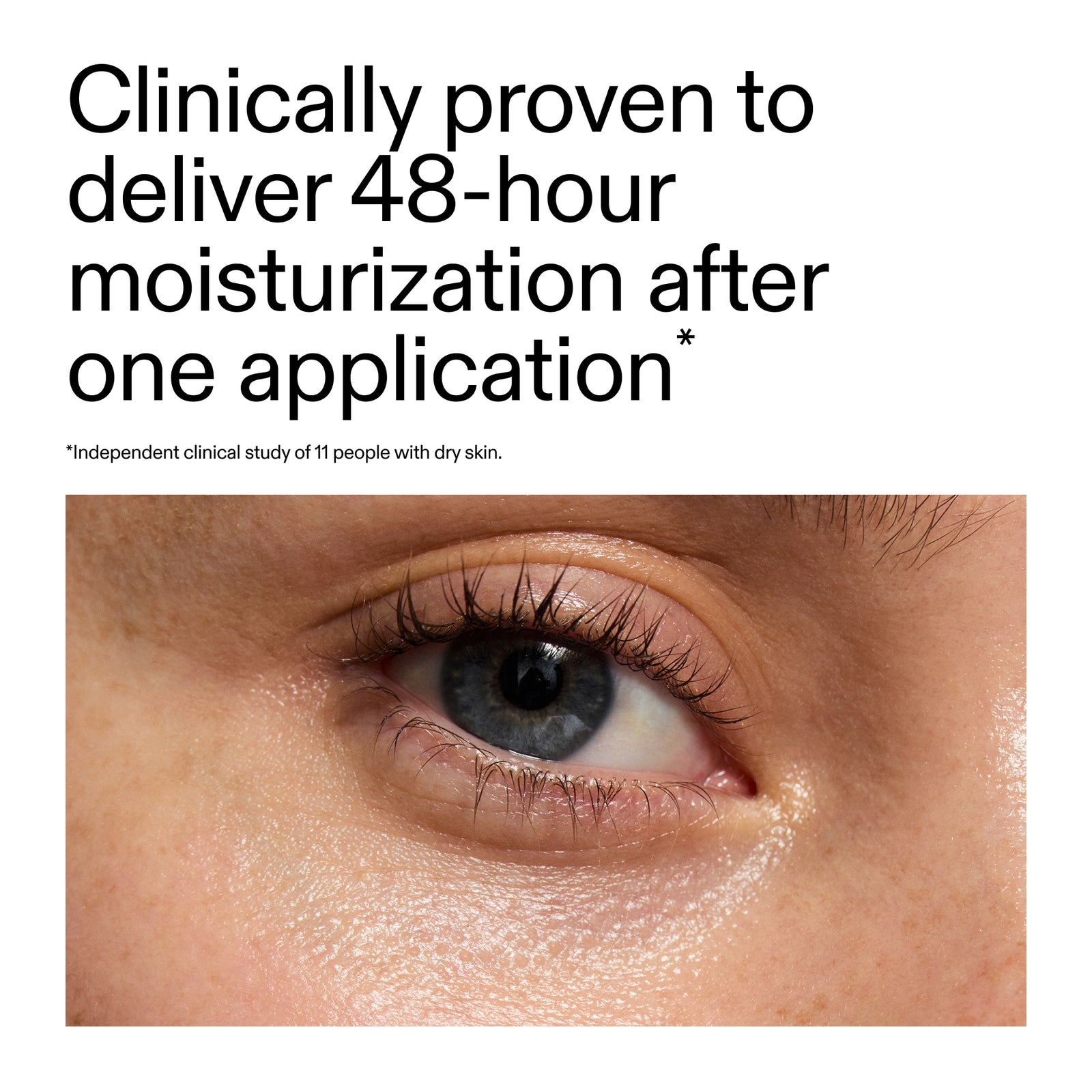 Close-up of an eye with text claiming 48-hour moisturization after one application of 10% Urea Moisturiser