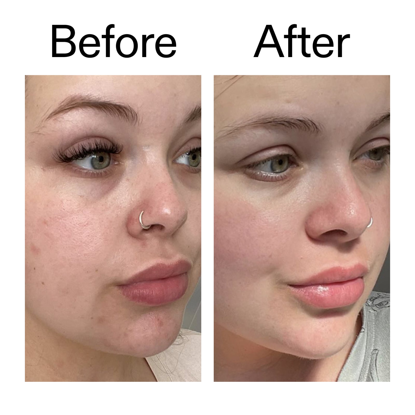 Before and after of customer using Omega Water Cream