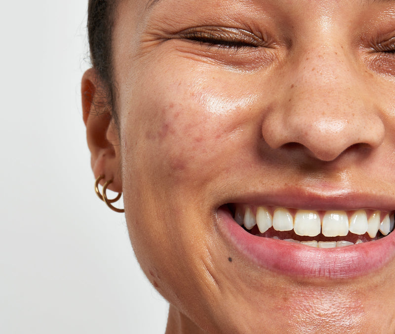 woman smiling into the camera with her eyes shut