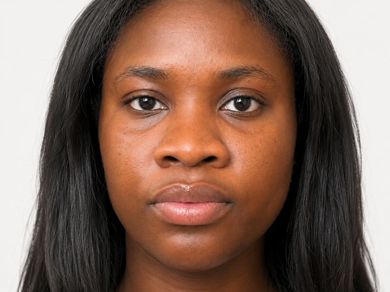 Why Oily Skin Gets Dehydrated Too