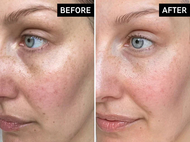 Melama before and after