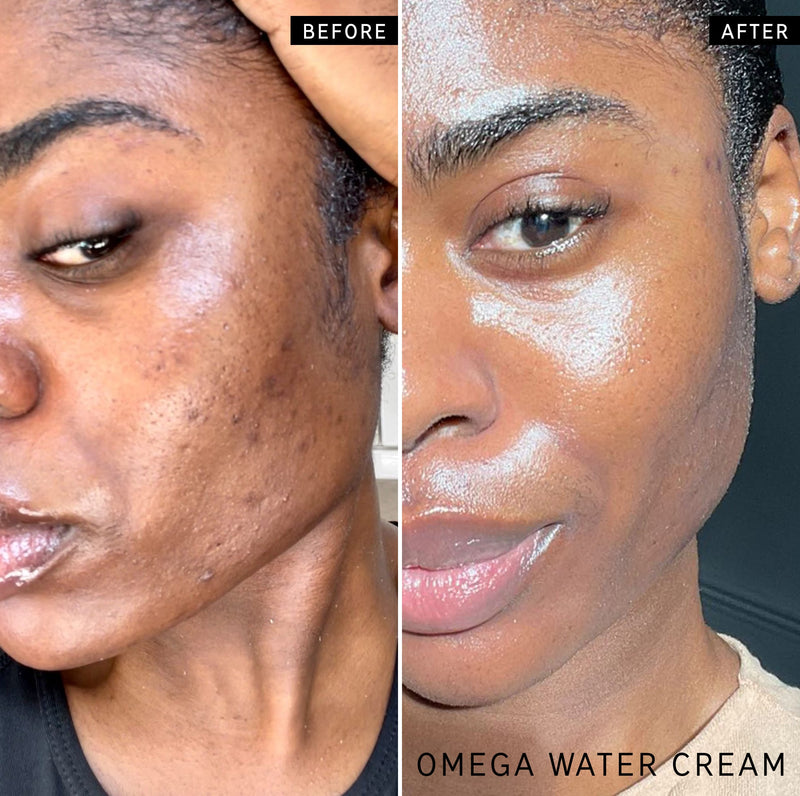 before and after of woman using omega water cream