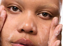 Salicylic Acid Or Benzoyl Peroxide: Which Is Better For Acne?