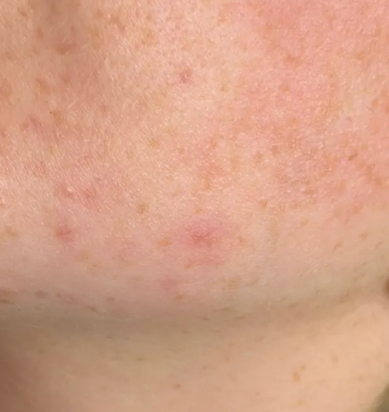 close up on skin