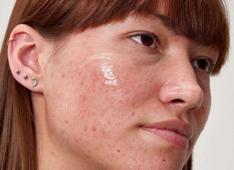 Model with serum on her face
