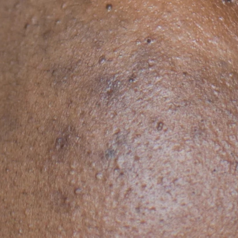 close up of dark marks