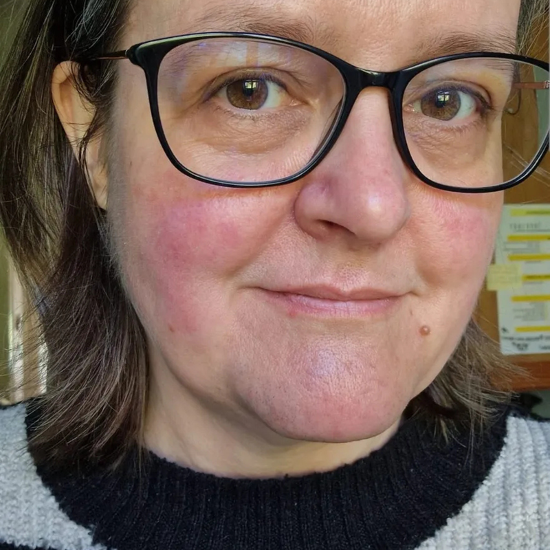 woman with red cheeks