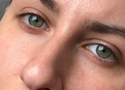 Oily Skin in Summer: How to Keep Shine Under Control