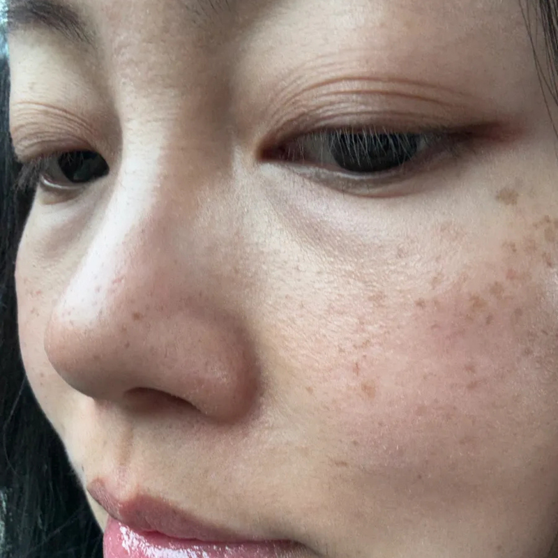 Close up of puffy eyes