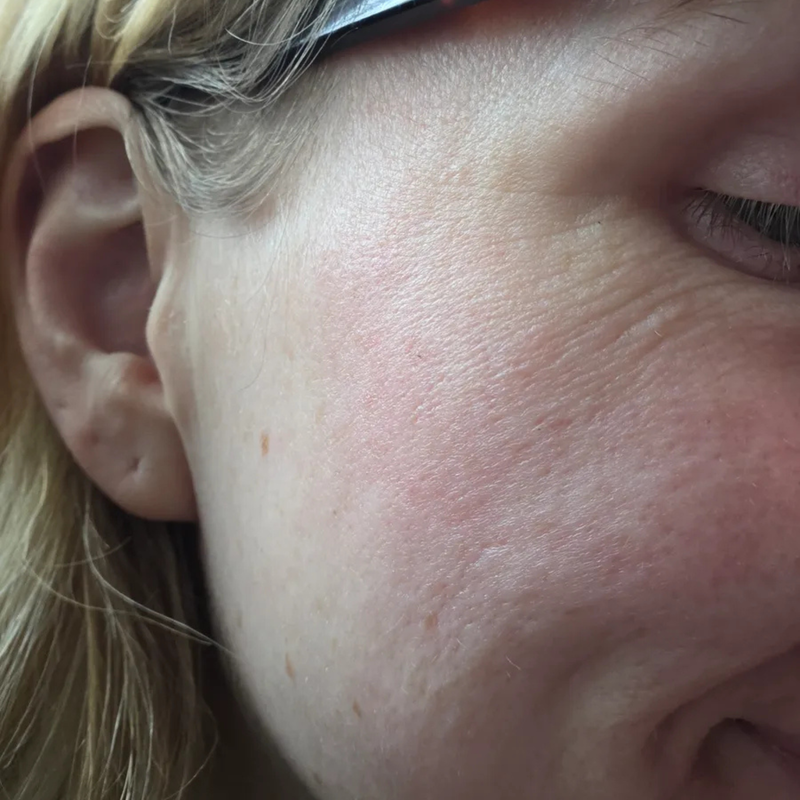 womans cheek