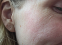 Natural Alternatives to Retinol: Do They Actually Work?