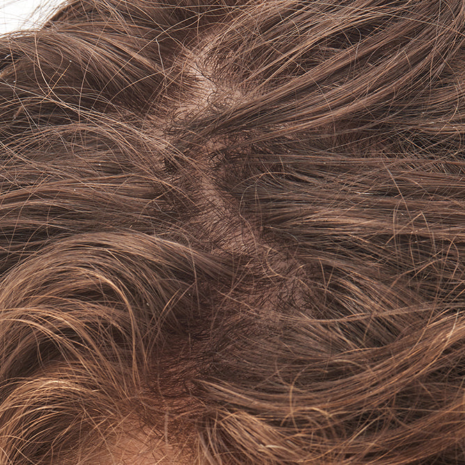 close up on scalp