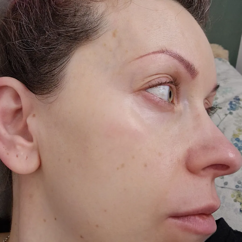 close up of womans cheek