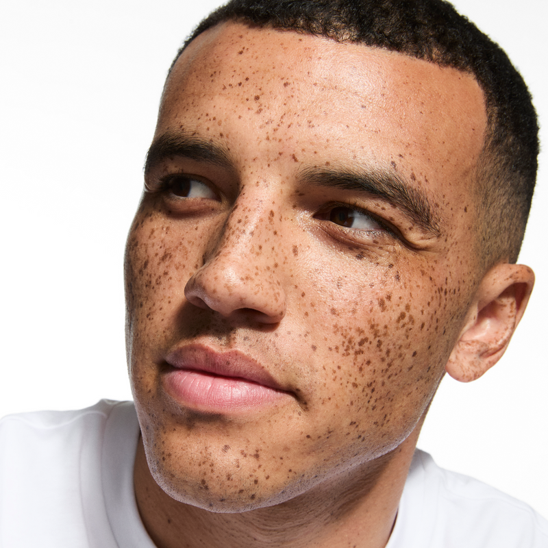 man with freckles