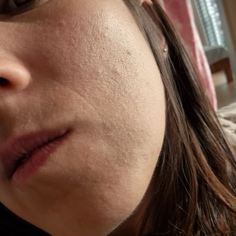 close up of uneven skin texture