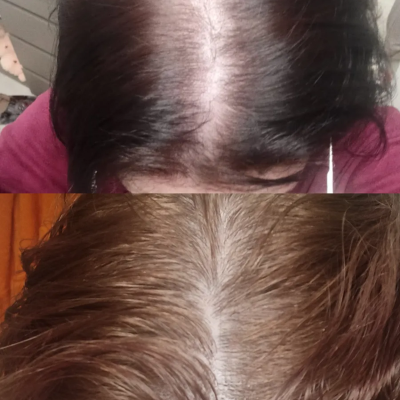 before and after using hair growth serum