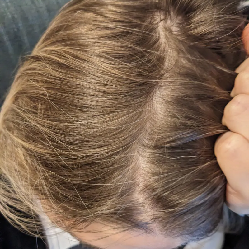close up on scalp