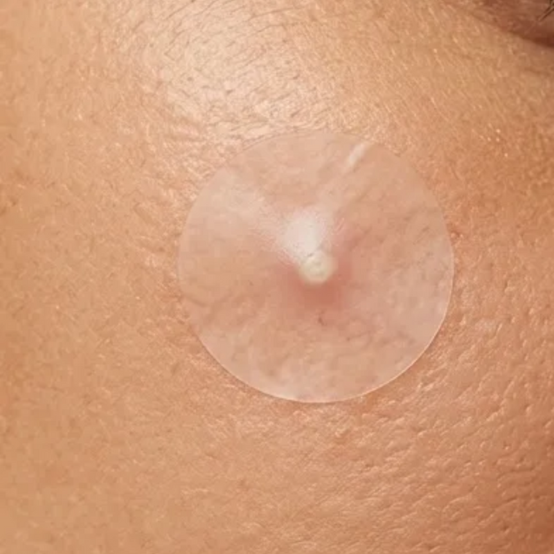 pimple patch on spot