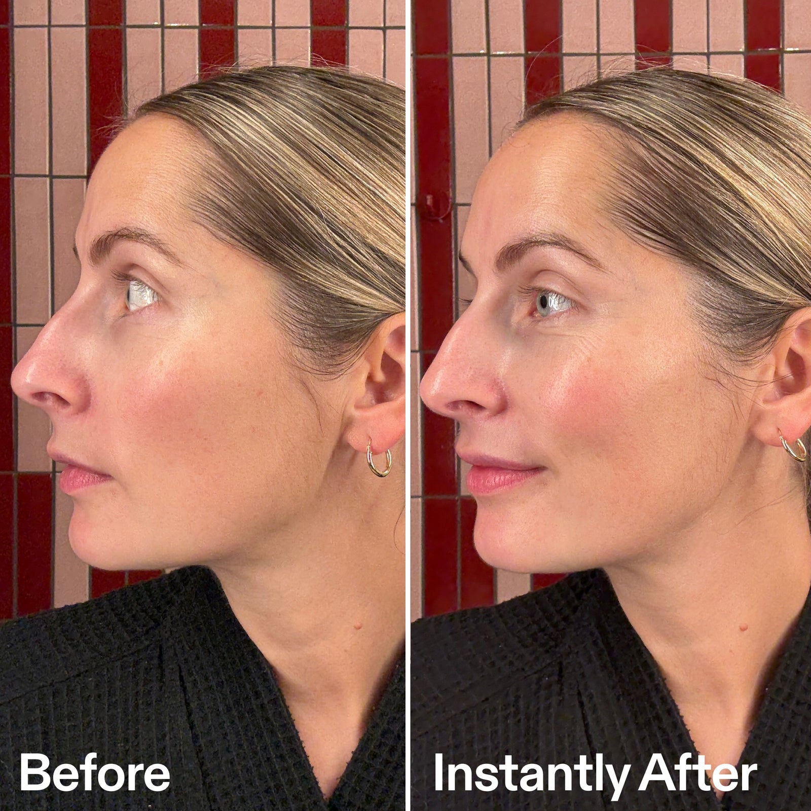 Side-by-side comparison of a woman's face labeled 'Before' and 'Instantly After' against a red tiled wall.