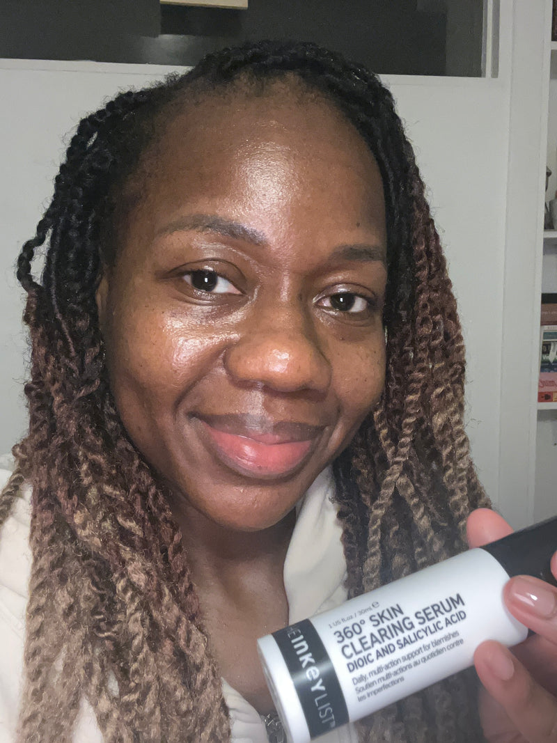 A woman with braided hair holds a white and black tube of 360° Skin Clearing Serum in front of her face, showing the product packaging in a close-up selfie-style shot.