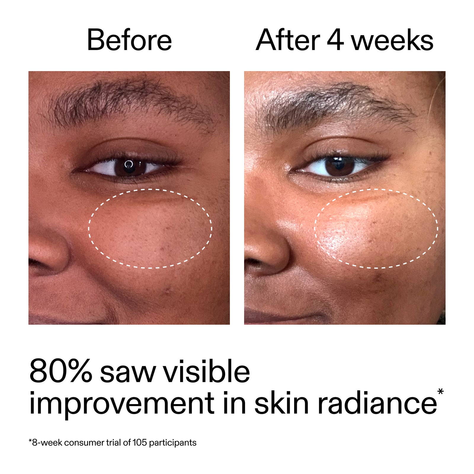 Before and after comparison of skin radiance with text indicating improvement.