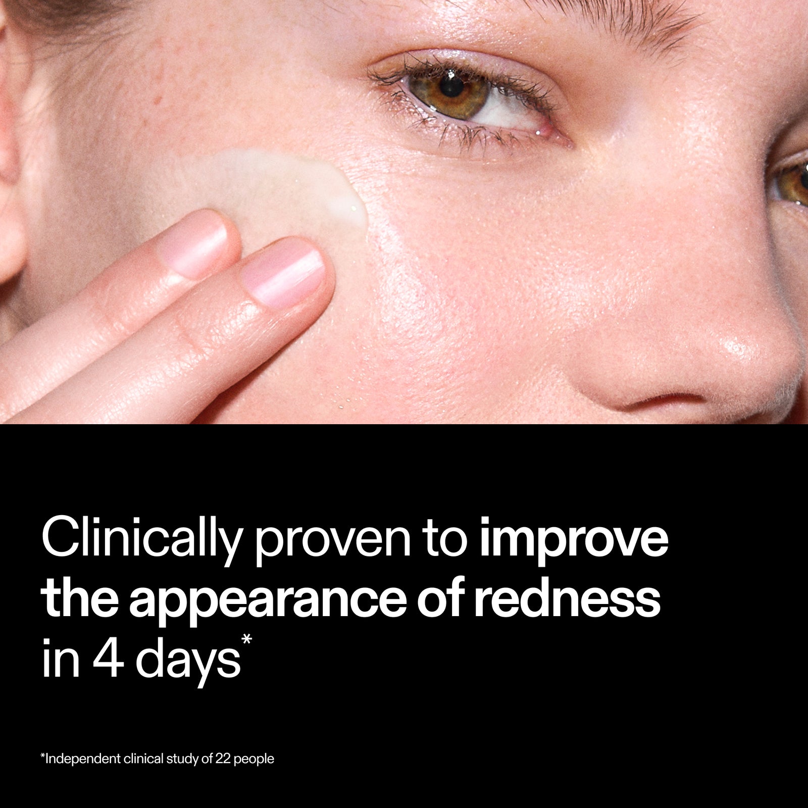 The INKEY List Azelaic Acid Redness Relief Solution – clinically proven to reduce the appearance of redness