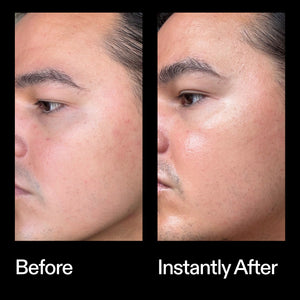 Before and instant after results using The INKEY List Azelaic Acid Redness Relief Solution