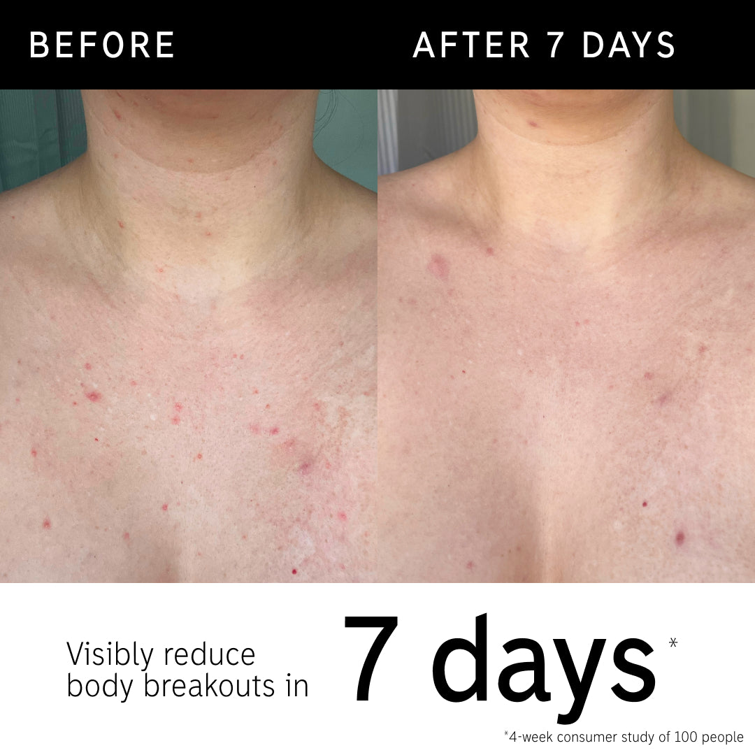 Body breakout key claim statistics for glycolic stick 