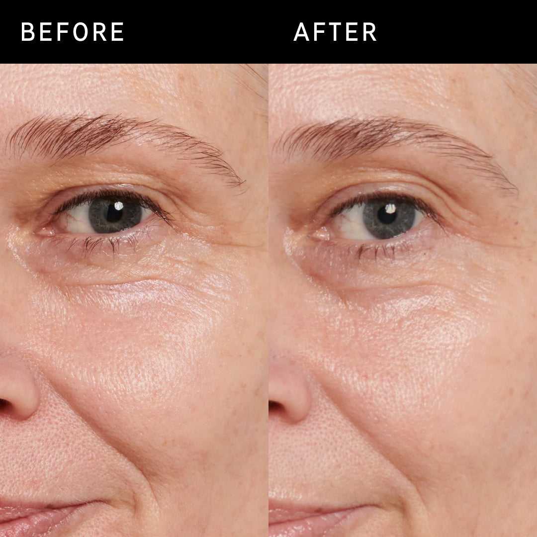 2 images of a mature model's face side by side to show before and after using Retinol Eye Cream for 6 weeks