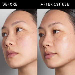 2 images of a model's face side by side to show the before and after using Hyaluronic Acid Serum just once