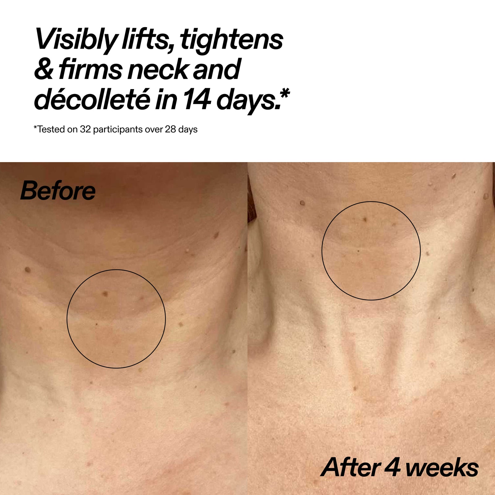 Before-and-after comparison of a person's neck and décolleté area, with text stating 'Visibly lifts, tightens & firms neck and décolleté in 14 days.' and 'After 4 weeks.