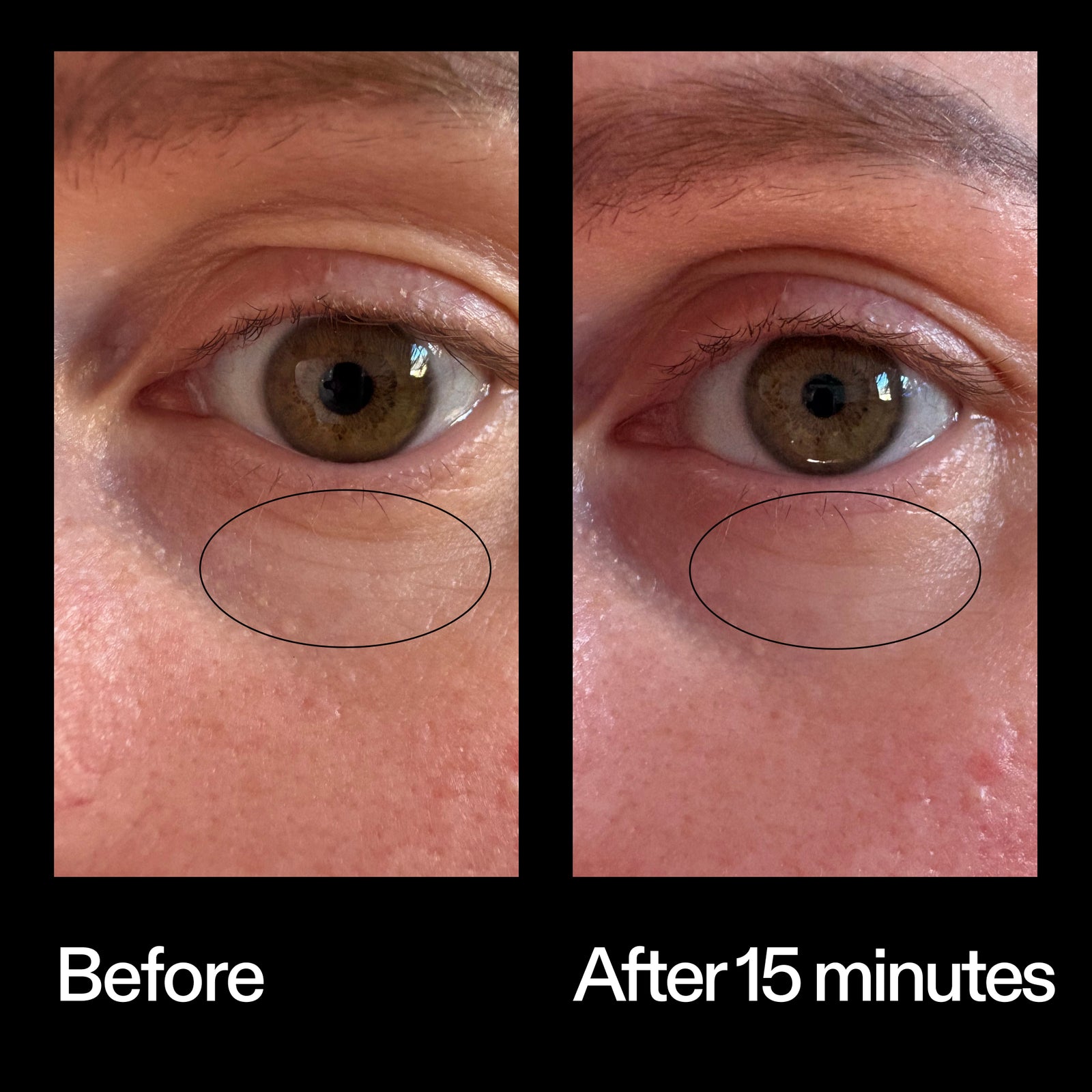Before and after results using The INKEY List Bio-Active Ceramide Eye Cream after 15 minutes