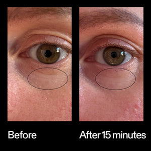Before and after results using The INKEY List Bio-Active Ceramide Eye Cream after 15 minutes