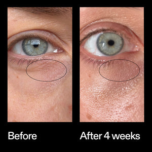 Before and after results using The INKEY List Bio-Active Ceramide Eye Cream after 4 weeks