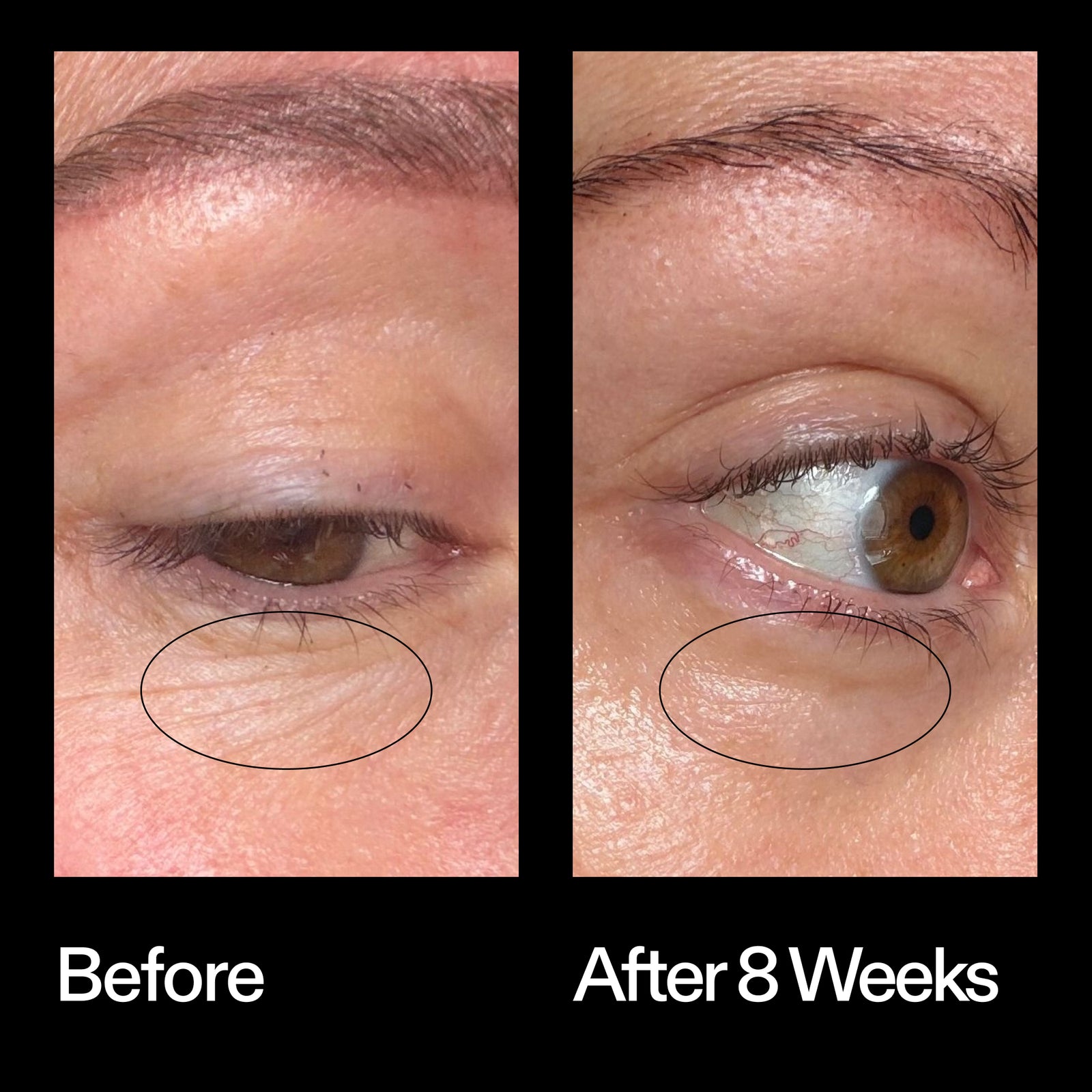 Before and after results using The INKEY List Bio-Active Ceramide Eye Cream after 8 weeks