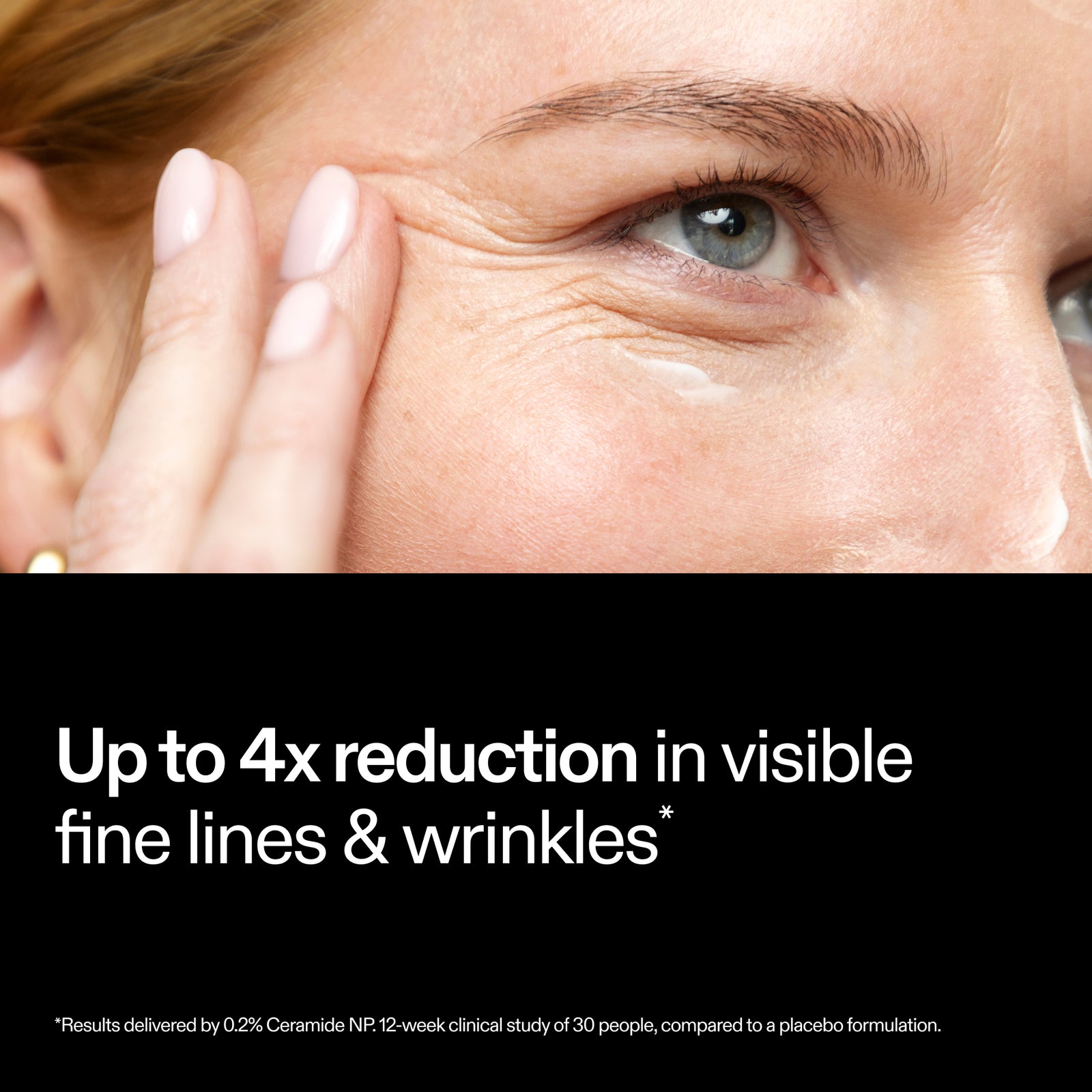 Close-up of eye area showing up to 4x reduction in visible fine lines and wrinkles with The INKEY List Bio-Active Ceramide Moisturiser