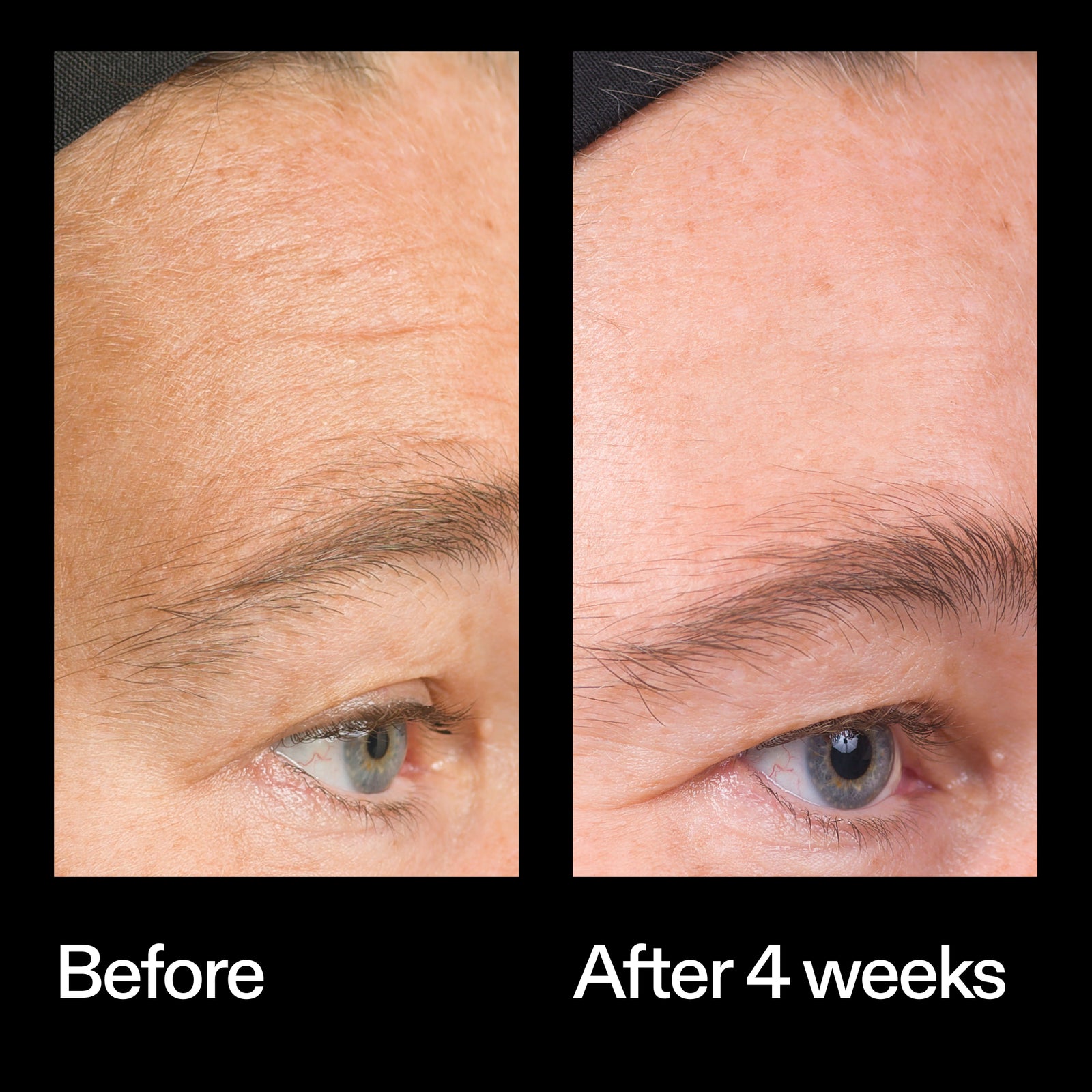 Before and after results using The INKEY List Bio-Active Ceramide Moisturiser