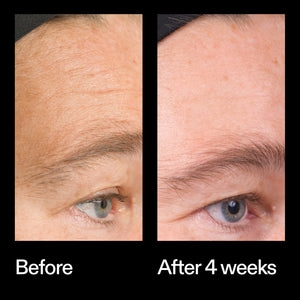 Before and after results using The INKEY List Bio-Active Ceramide Moisturiser