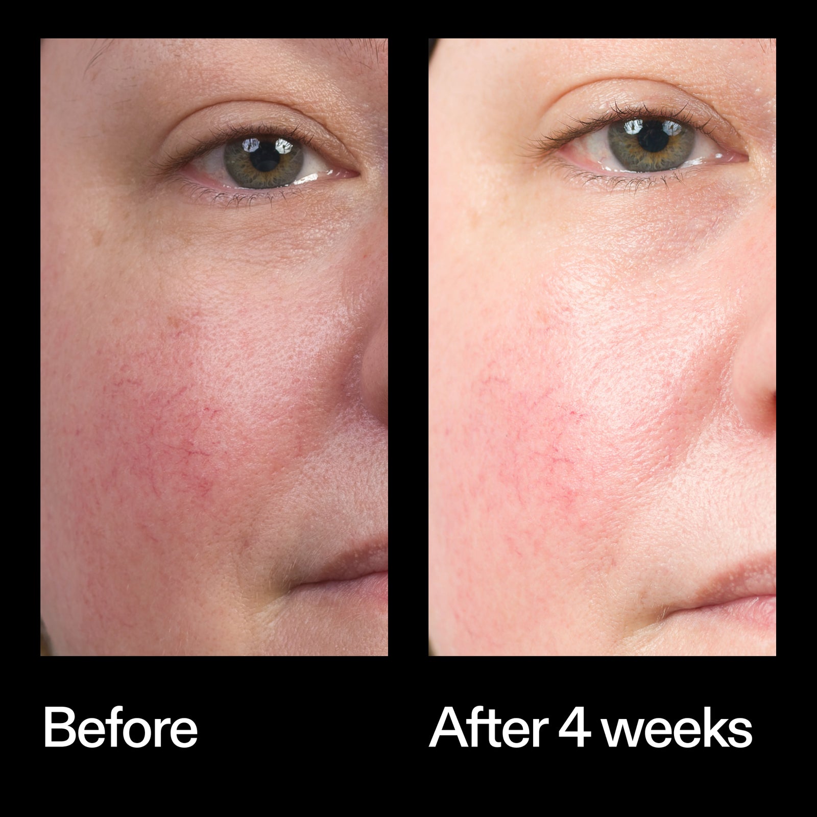 Before and after results using The INKEY List Bio-Active Ceramide Moisturiser