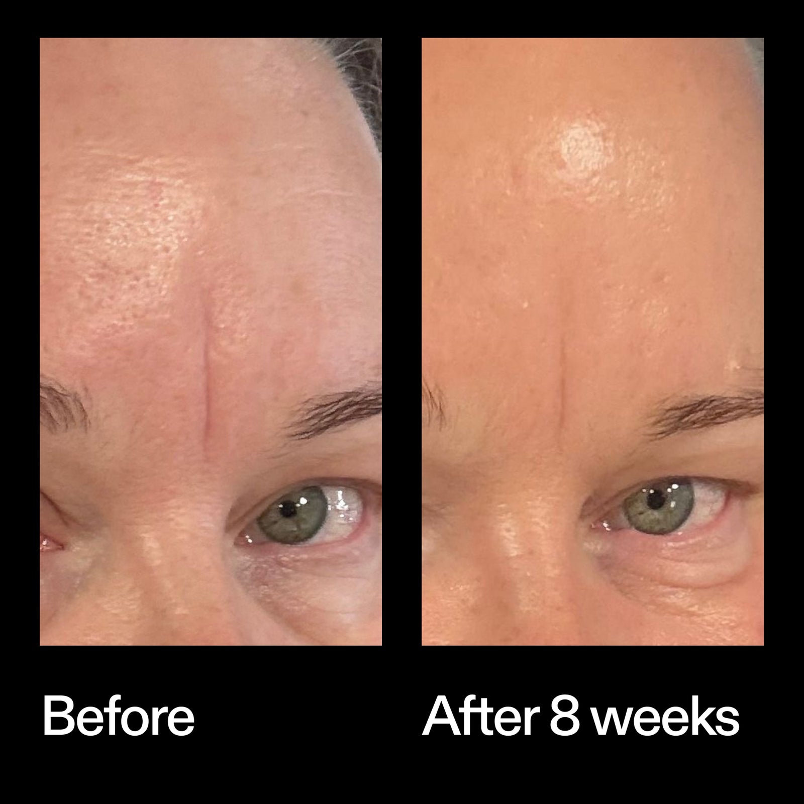 Before and after results using The INKEY List Bio-Active Ceramide Moisturiser