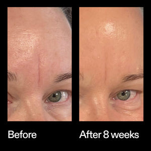 Before and after results using The INKEY List Bio-Active Ceramide Moisturiser