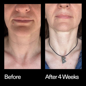 Before and after results using The INKEY List Bio-Active Ceramide Neck Stick after 4 weeks